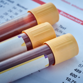 PPRX  PPRX  Blood Test PPRX Testosterone